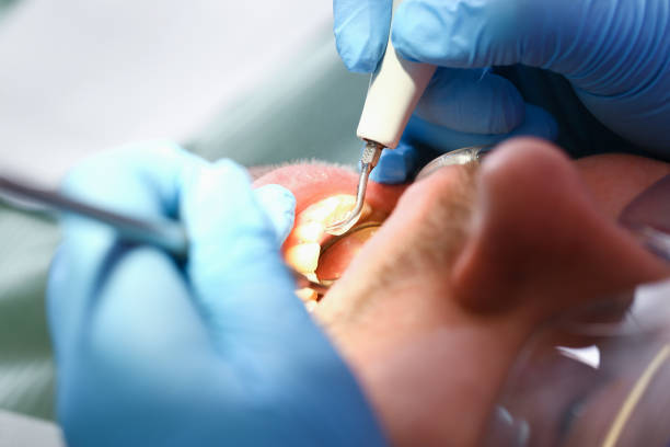 Best After-Hours Dental Trauma Care in Meggett, SC