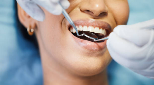 Best Emergency Wisdom Teeth Removal in Meggett, SC